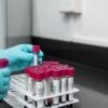 I en tid där hälsomedvetenhet blir allt viktigare, har behovet av tillgängliga, exakta och bekväma medicinska tester aldrig varit större. Werlabs, ett banbrytande svenskt hälsoteknikföretag, ligger i framkant av denna rörelse, och förändrar landskapet för medicinsk diagnostik genom att göra det mer tillgängligt för den vardagliga individen. Den här artikeln fördjupar sig i hur Werlabs ger människor möjlighet att förstå och hantera sin hälsa bättre genom sitt innovativa tillvägagångssätt för medicinska tester.