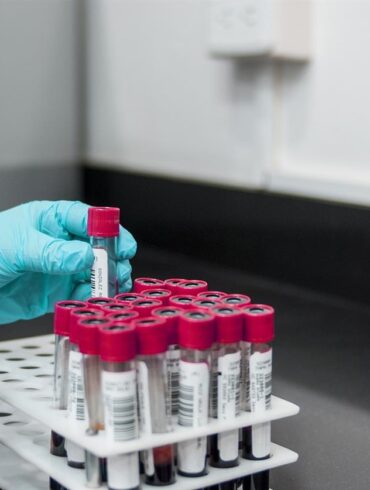 I en tid där hälsomedvetenhet blir allt viktigare, har behovet av tillgängliga, exakta och bekväma medicinska tester aldrig varit större. Werlabs, ett banbrytande svenskt hälsoteknikföretag, ligger i framkant av denna rörelse, och förändrar landskapet för medicinsk diagnostik genom att göra det mer tillgängligt för den vardagliga individen. Den här artikeln fördjupar sig i hur Werlabs ger människor möjlighet att förstå och hantera sin hälsa bättre genom sitt innovativa tillvägagångssätt för medicinska tester.